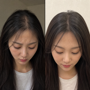 Before and after