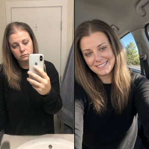 Before and after