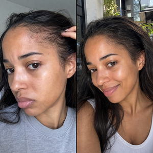 Before and after